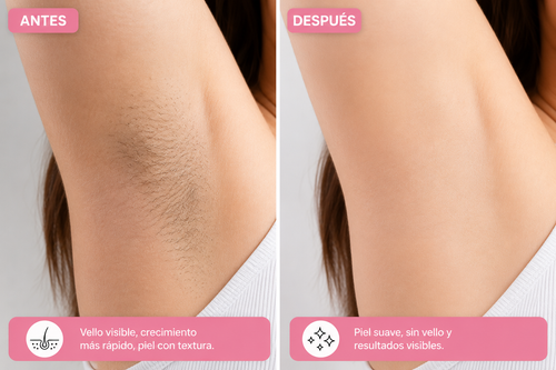 Depiladora IPL Laser eléctrica Profesional, pago contraentrega